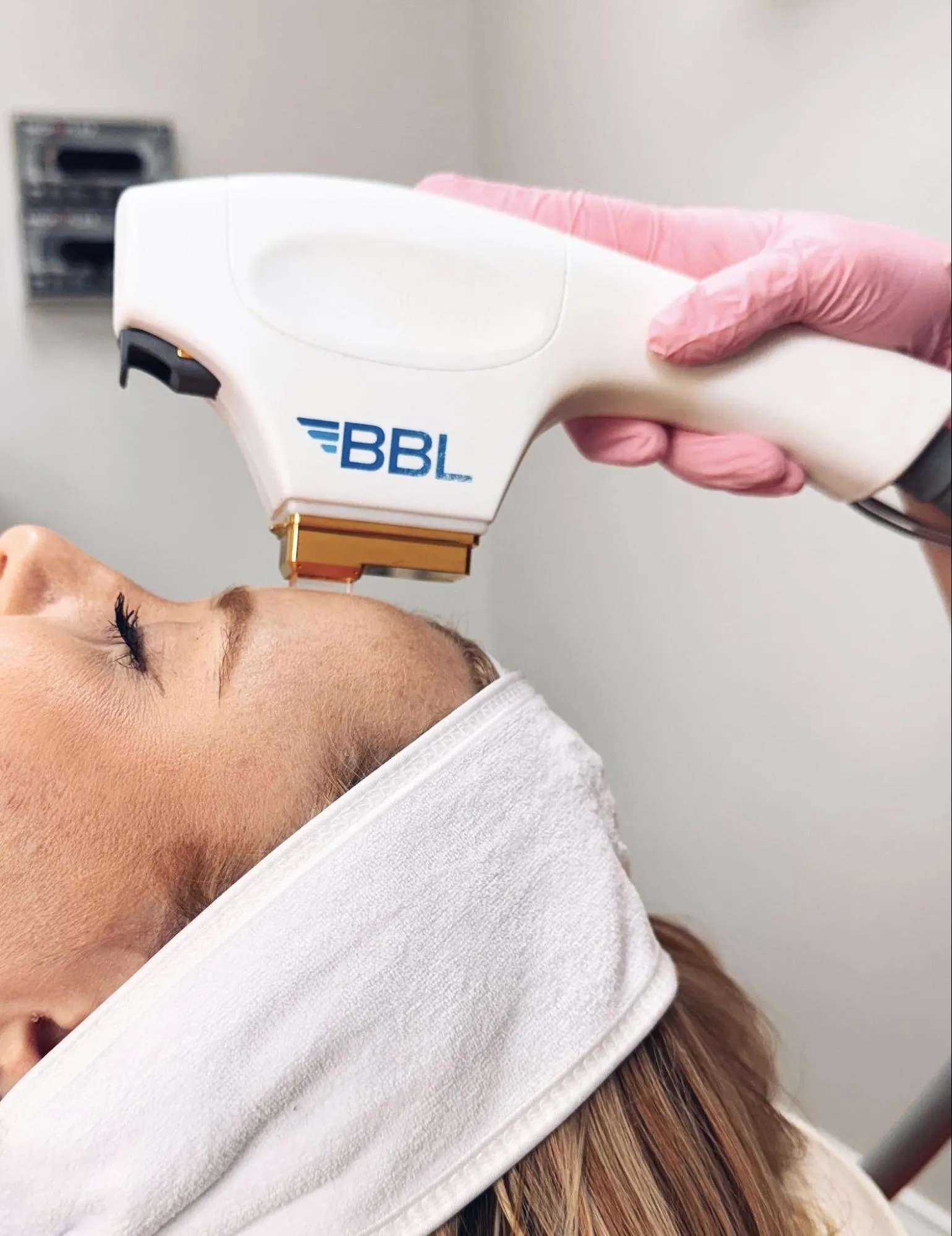 BBL Treatment | Pure Skin and Aesthetics in Stillwater, OK