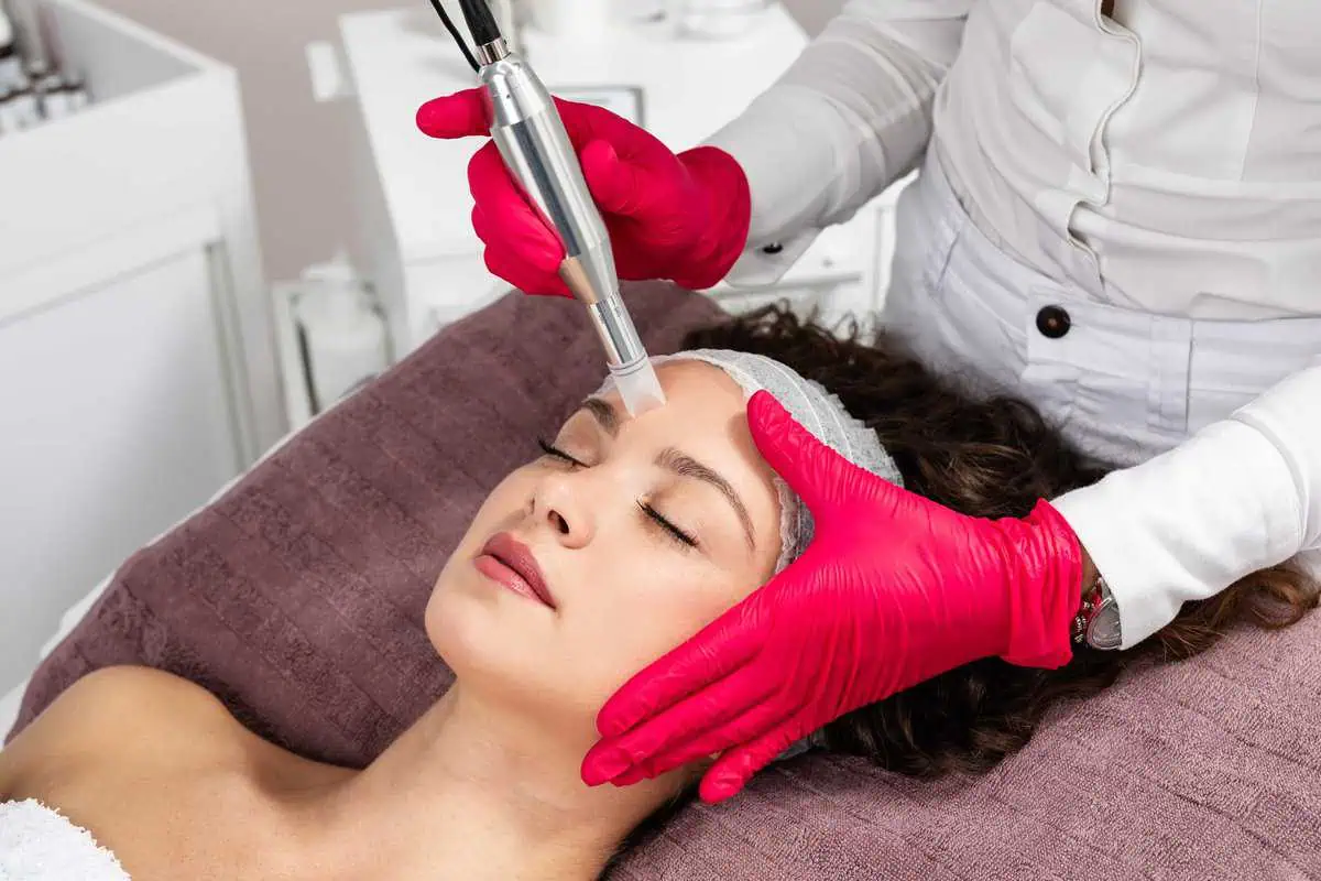 Microneedling by Pure Skin and Aesthetics in Stillwater, OK