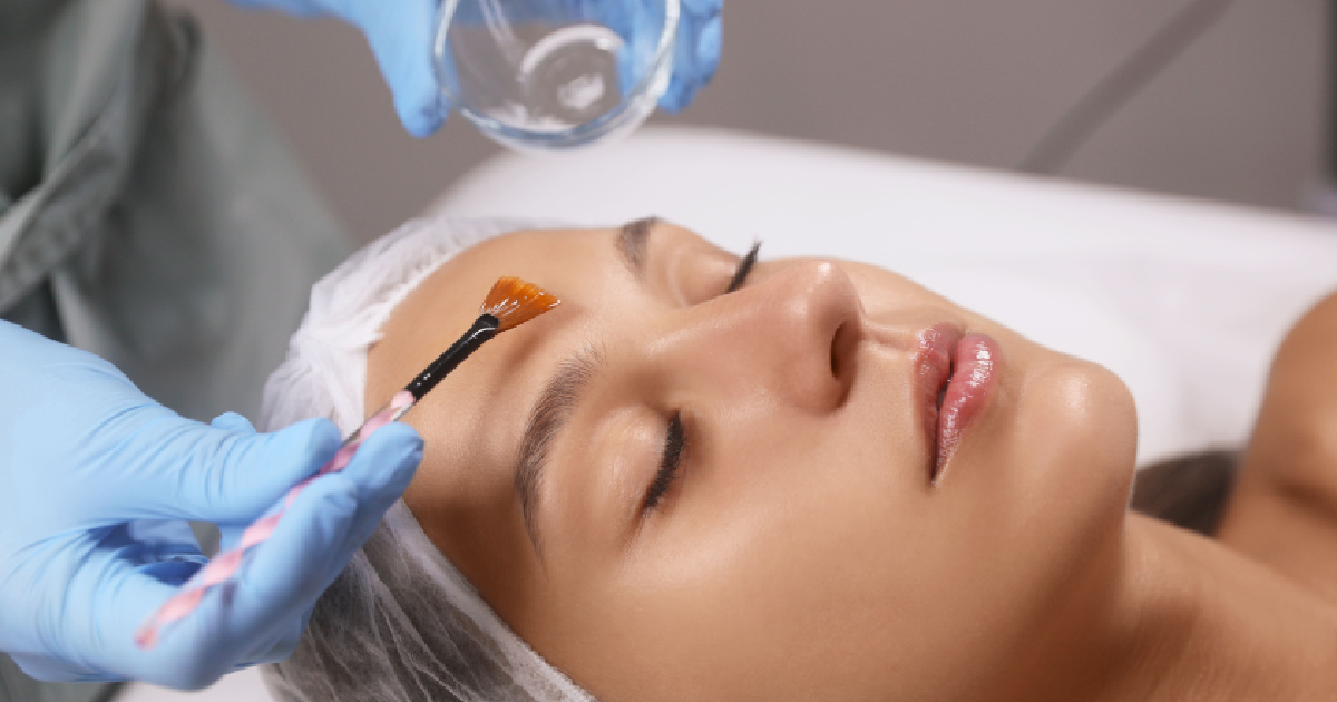 Woman receiving a chemical peel treatment at a skincare clinic, with a professional applying solution to her forehead using a brush while she lies with eyes closed in Stillwater, OK