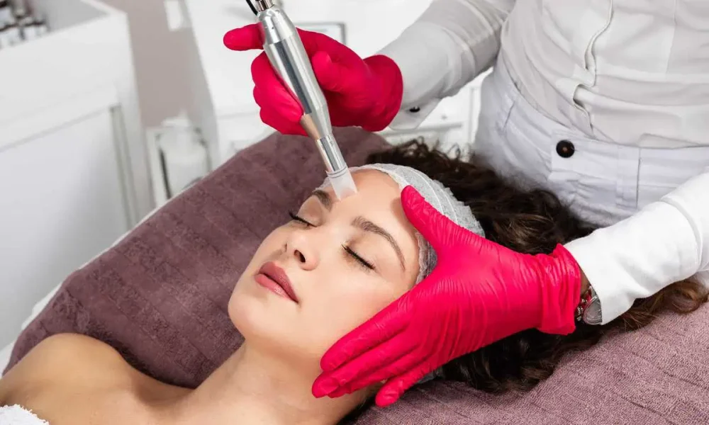 Microneedling by Pure Skin and Aesthetics in Stillwater, OK