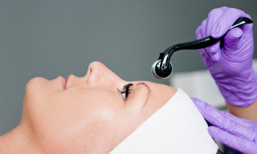 What Is Microneedling How It Works And The Real Benefits