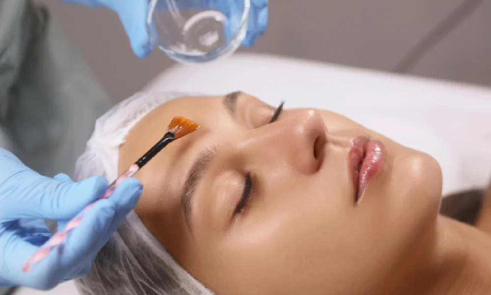 Woman receiving a chemical peel treatment at a skincare clinic, with a professional applying solution to her forehead using a brush while she lies with eyes closed in Stillwater, OK