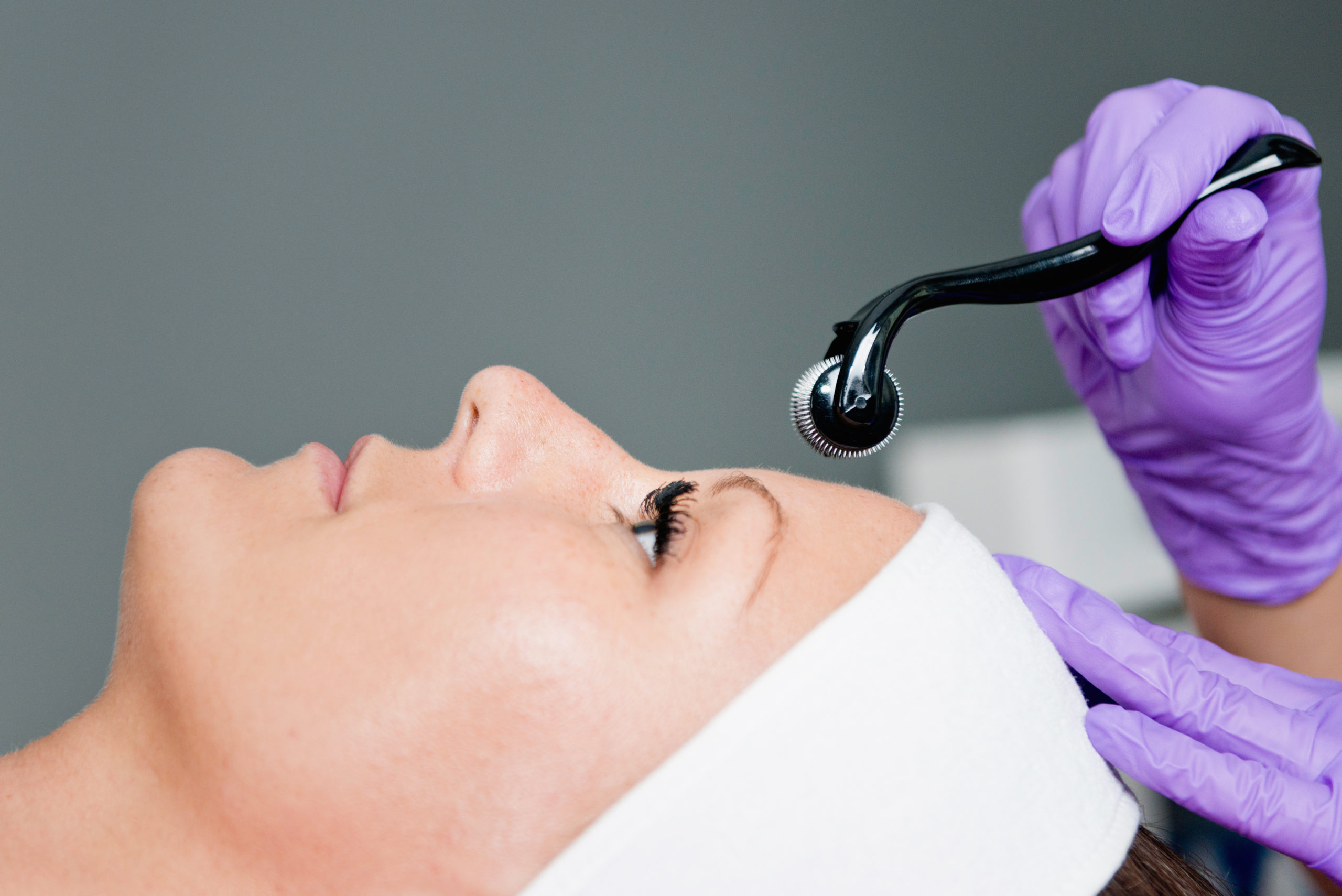 What Is Microneedling How It Works And The Real Benefits